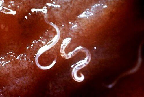 paraziți din interiorul corpului