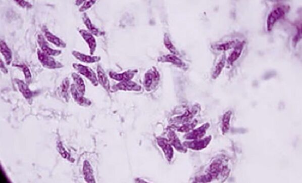 parazitul protozoar Toxoplasma gondii, agent cauzator al toxoplasmozei
