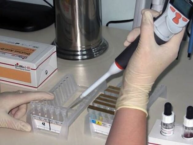 Teste de laborator pentru diagnosticarea bolilor parazitare